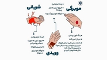 کنترل خونریزی در مواقع بحرانی